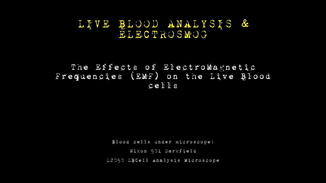 The Effects of ElectroMagnetic Frequencies (EMF) on the Live Blood cells-0.jpg
